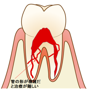 複雑な歯の構造