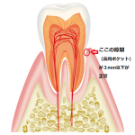 歯周病　正常な歯